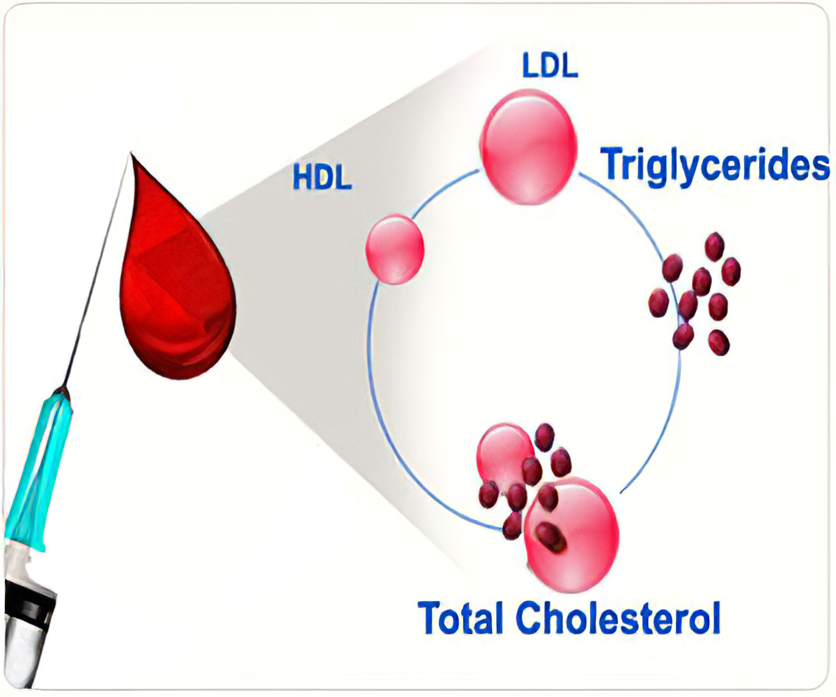 ASSOCIATION BETWEEN LIPID ABNORMALITIES AND COVID MORTALITY